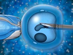 لقاح مصنوعی یا  IVF